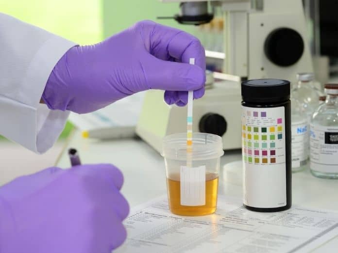 Factors That Affect Drug Test Results